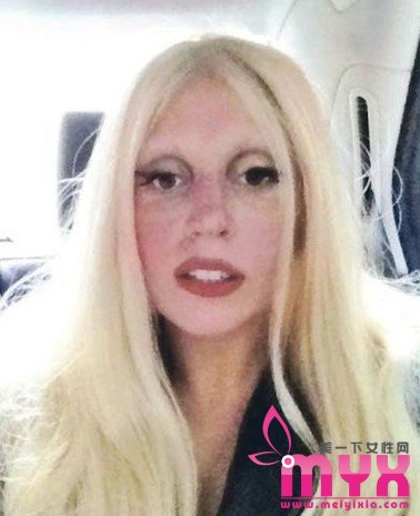 Lady Gaga香港巡回演唱会 红血丝密布脸颊，粉底都遮不住