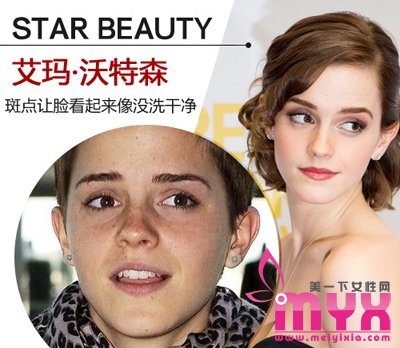 欧美女星以斑为美 元芳你怎么看！