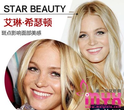 欧美女星以斑为美 元芳你怎么看！