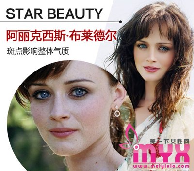 欧美女星以斑为美 元芳你怎么看！