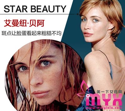 欧美女星以斑为美 元芳你怎么看！