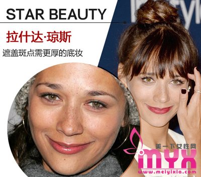 欧美女星以斑为美 元芳你怎么看！