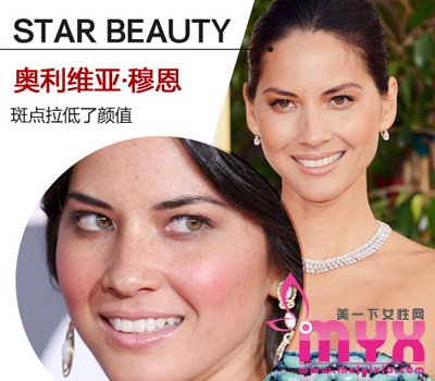欧美女星以斑为美 元芳你怎么看！