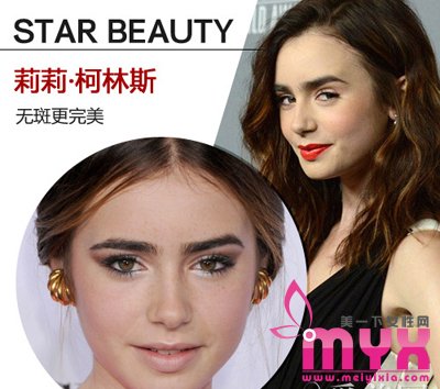 欧美女星以斑为美 元芳你怎么看！