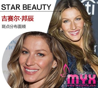 欧美女星以斑为美 元芳你怎么看！