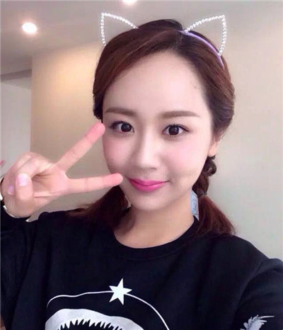 高圆圆美美的发际线遭遇危机？如何打造完美发际线