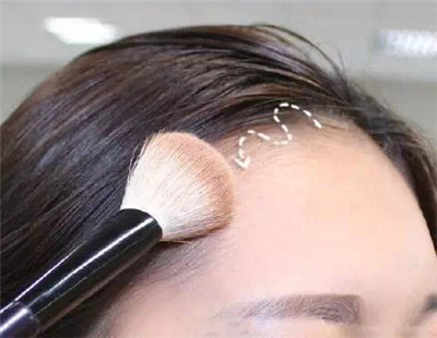 高圆圆美美的发际线遭遇危机？如何打造完美发际线