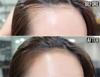 高圆圆美美的发际线遭遇危机？如何打造完美发际线