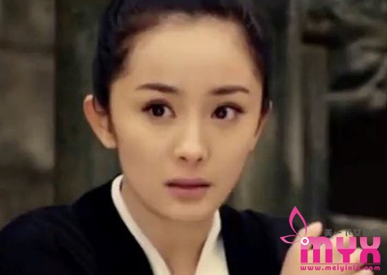 杨幂发际线为什么会后移 怎么拯救发际线