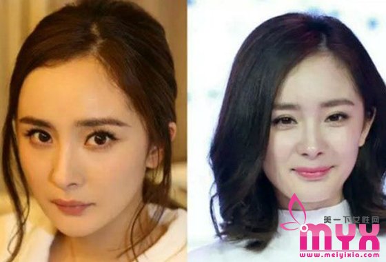 杨幂发际线为什么会后移 怎么拯救发际线