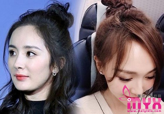 杨幂发际线为什么会后移 怎么拯救发际线