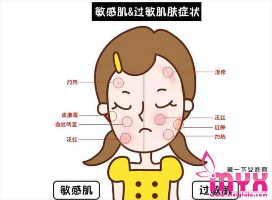 敏感肌肤有什么症状 敏感肌和过敏肌的区别
