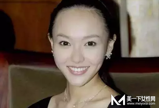 发际线不好看怎么修饰 4个方法打造漂亮发际线