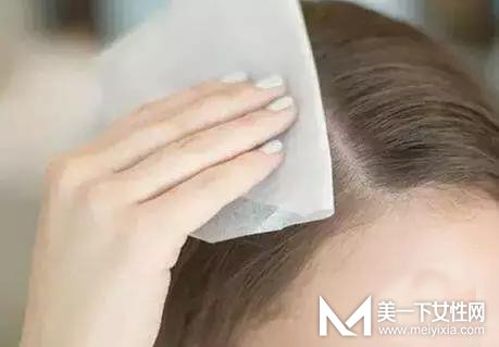 夏季头发出油的原因是什么 头发爱出油怎么办