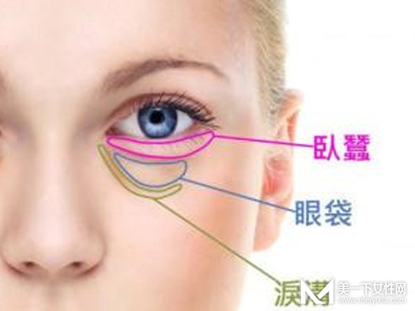 揭秘微整形之去眼袋手术 眼袋的形成原因及治疗误区