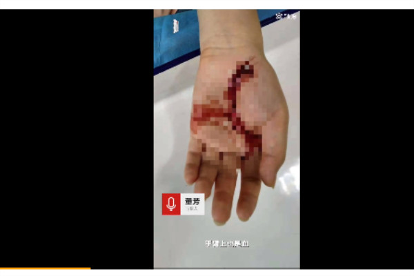 遭遇家暴离婚冷静期有必要吗 遭遇家暴该怎么做