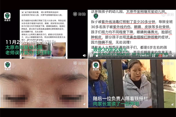 30余幼儿眼睛被紫光灯灼伤 孩子受伤情况严重