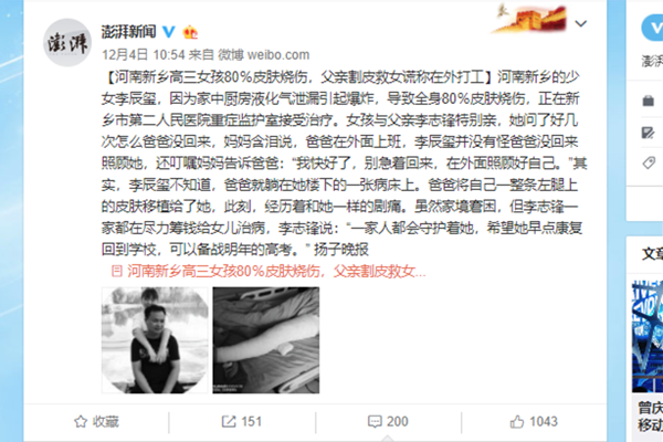 父亲割皮救女 父亲含泪的谎言伟大的父爱