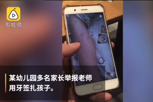 老师牙签扎幼童 孩子身上小红点触目惊心