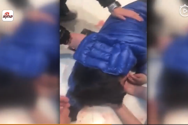 酒店大门砸伤男童 现场照片曝光孩子头部重击