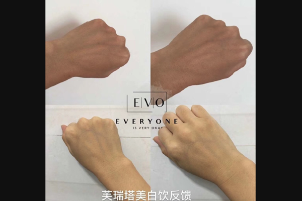 张嘉倪代言的美白饮 芙瑞塔美白饮真的有效吗