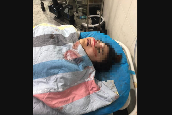 贵阳19岁女孩隆鼻死亡 死亡现场曝光医院竟销毁证据