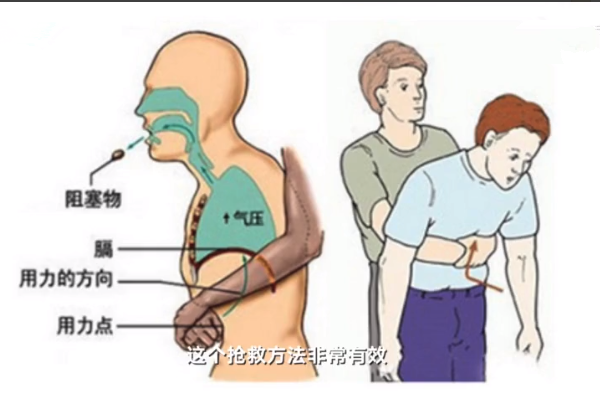 男童吃花生窒息 现场照片曝光倒挂急救失败