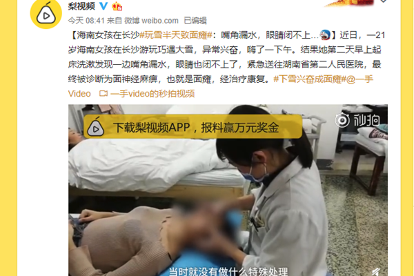 下雪兴奋成面瘫 脸歪嘴斜照片曝光该心疼还是该笑