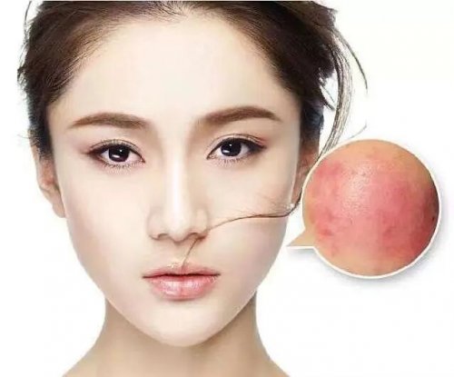 拒绝烂脸,修复皮肤屏障 拒绝烂脸,修复皮肤屏障