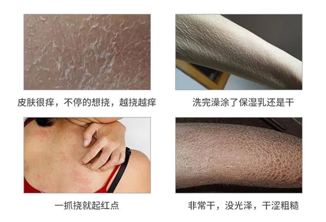 拒绝烂脸，修复皮肤屏障