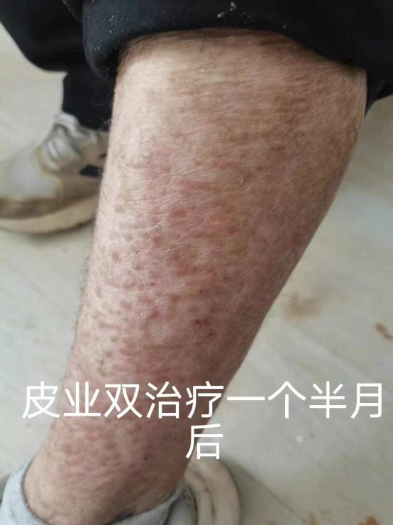 C:\Users\fd\Documents\WeChat Files\wxid_o9hdhyiotcms22\FileStorage\Temp\281676d9f0584aad9c6d796c486e18b.jpg