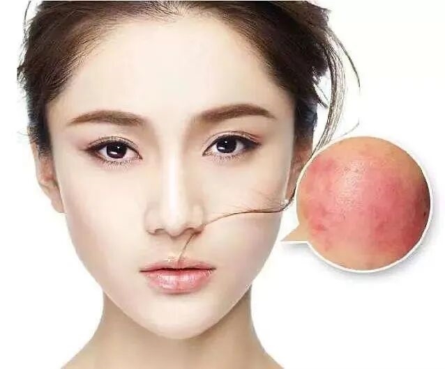 拒绝烂脸，修复皮肤屏障