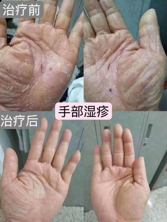 C:\Users\fd\Documents\WeChat Files\wxid_o9hdhyiotcms22\FileStorage\Temp\62e7e2c5fc7bc9b4b0ba0564c4a9ee3.jpg