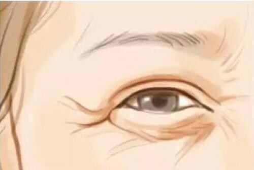 北京幻眼国际帮你对抗眼部老化